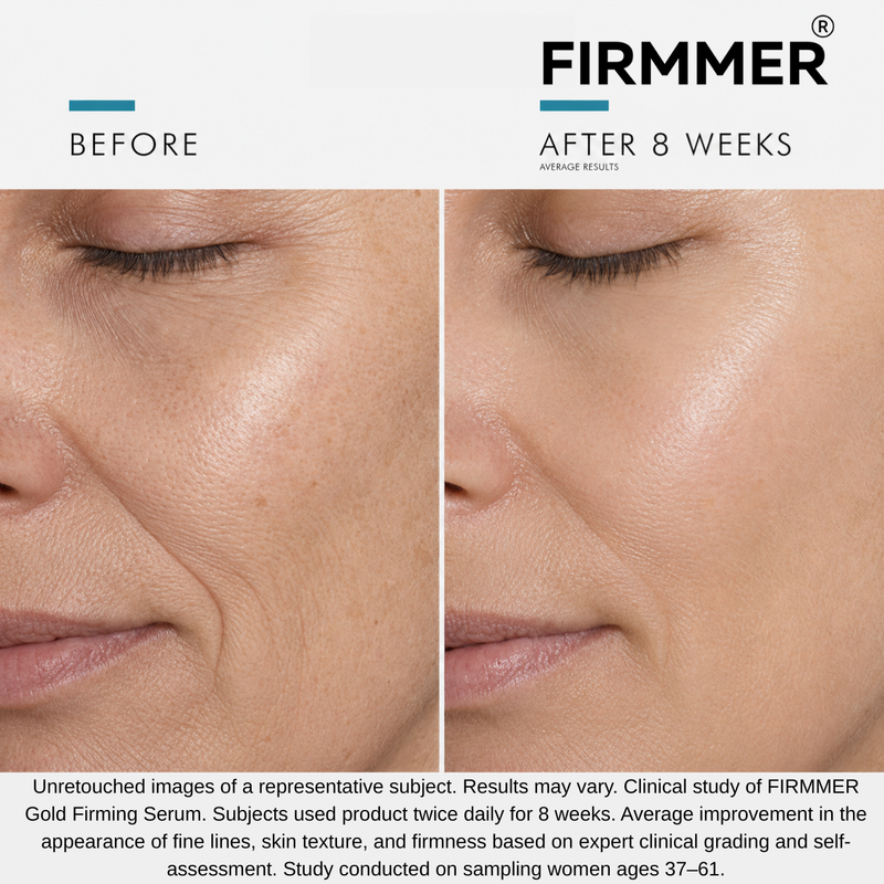 Before and After Results